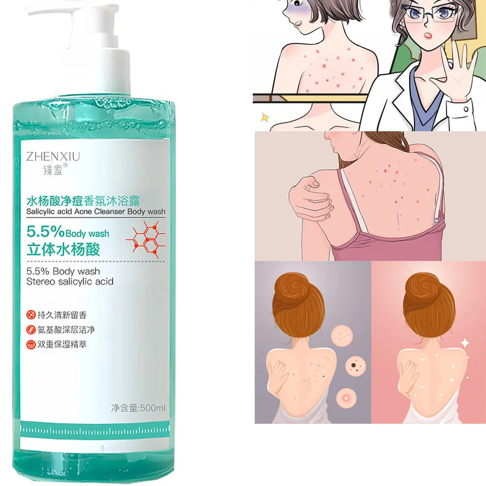 16.9 oz Salicylic Acid Body Wash